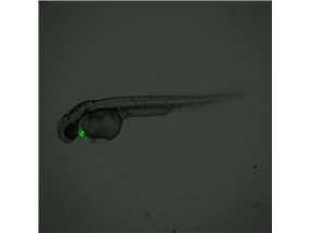 	cardiac muscle cell plasma membrane