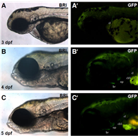 <p>The  transgenic zebrafish marks only bone structures derived from osteoblasts.</p>