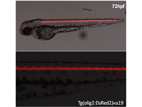 Oligodendrocyte