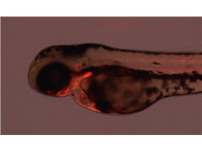  pharyngeal poucheson